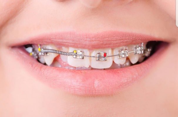 ¿Que es la ortodoncia ?
